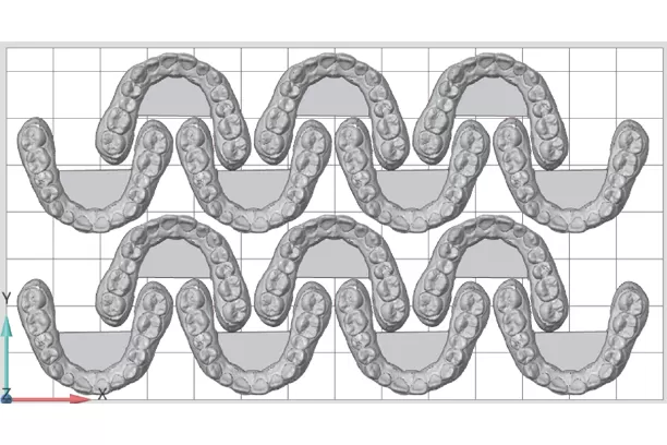 Orthodontic Models