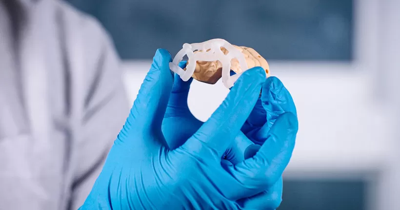 Resin 3D Printing in Dentistry for Precise Surgical Guides and Dental Implants